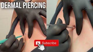 This Is For You If You Want a DERMAL PIERCING 