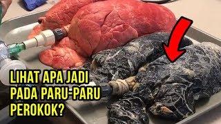 Mengejutkan Perbezaan Paru-Paru Perokok Setelah 20 Tahun Merokok ● Relaxlah.my