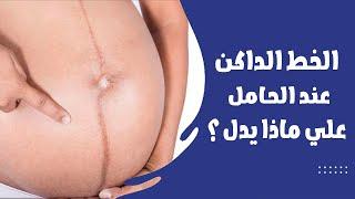 خط الحمل   مشاهد تعرض لاول مره