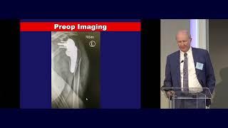 20  Proximal Humerus   Michael Mckee MD