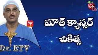 Mouth Cancer - Treatment  మౌత్ క్యాన్సర్ - చికిత్స  Dr.ETV  8th December 2021  ETV Life