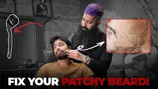 How To Fix Patchy Beard  Patchy Beard Hacks  Beard Growth  Grooming Masterclass EP 2