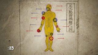 How Does Acupuncture Work?  WebMD