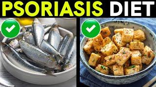 Psoriasis Treatment and Diet Foods to Eat and Avoid