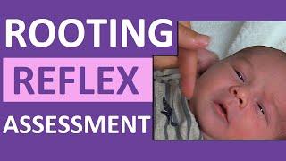 Rooting Reflex in Newborn Infant Baby  Pediatric Nursing Assessment