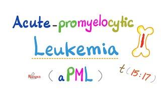 Acute Promyelocytic Leukema aPML - AML M3 Subtype -  t1517 - Vitamin A ATRA - Hematology