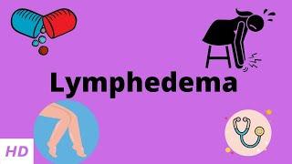 Lymphedema Causes Signs and Symptoms Diagnosis and Treatment.