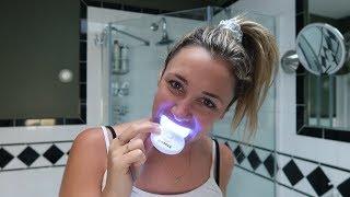 Do at-home teeth whitening kits really work?  Glam Lab