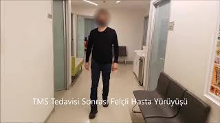 Felçli Hasta TMS Tedavisi Öncesi ve Sonrası  Yürüme