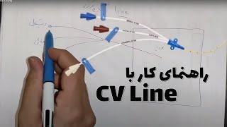 راهنمای کار با سی وی لاین CV Line در بخش مراقبت های ویژه