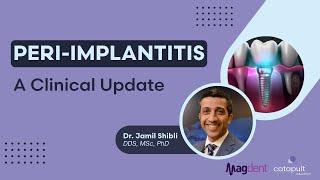 Dental Treatment Peri-Implantitis  Sep 13 2023