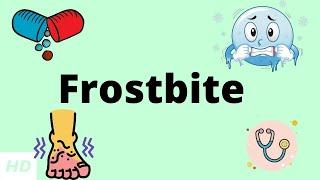 Frostbite Causes Signs and Symptoms DIagnosis and Treatment.