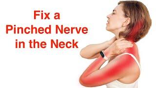 Fix a Pinched Nerve in the Neck With FREE Exercise Sheet