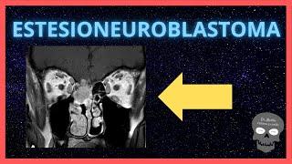 ESTESIONEUROBLASTOMA Hallazgos radiológicos