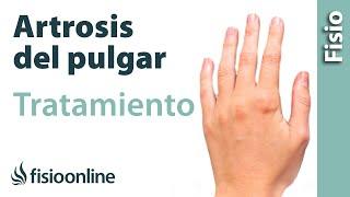 Qué es la rizartrosis  o artrosis trapeciometacarpiana del pulgar. Causas y tratamiento