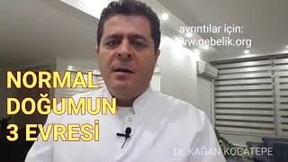 Normal doğumun 3 aşaması rahim ağzı açılması bebeğin ıkınmayla doğması ve plasentanın çıkması