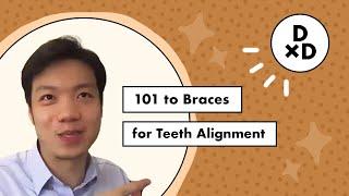 101 to Braces for Teeth Alignment  DoctorxDentist