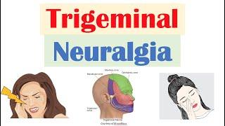 Trigeminal Neuralgia “Severe Facial Pain” Causes Pathophysiology Symptoms Diagnosis Treatment