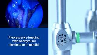 NIRICG Fluorescence Imaging an OPAL1™ Technology from KARL STORZ