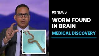 Surgeons pull an 8cm worm from womans brain in Canberra  ABC News