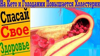 Холестерин повышается на Кето Диете Как уберечь себя от инфарктов инсультов и атеросклероза