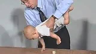 6.14 - Postural Reflexes Parachute Reflex - 6 Months - Infant Clinical ExaminationMRCP