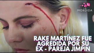 ¡LAMENTABLE RAKE MARTÍNEZ FUE AGREDIDA POR SU EX PAREJA JIMPIN