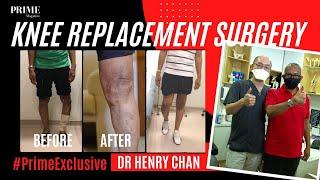 Experience and Thoughts of a Knee Replacement Patient  Dr Henry Chan