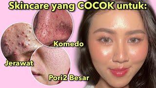 SKINCARE yang COCOK untuk Kulit Berjerawat Berminyak Bruntusan Komedoan & Pori-Pori Besar