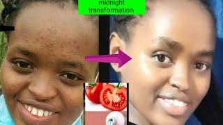 Tomato + colgate to remove pimples   how to remove blackspots and acne  how to smoothen your skin