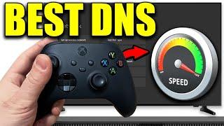 Best DNS Server For Xbox Series XS - 2024