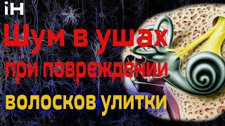 Повреждение волосков улитки внутреннего уха  - частая причина шума в ушах  iНЕВРОЛОГ