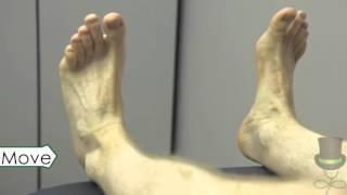 The Rheumatological Examination of the Ankles and Feet