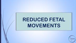 RCOG GUIDELINE REDUCED FETAL MOVEMENTS