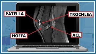 How to read a knee MRI?