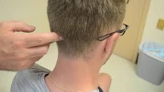 Tinels Sign - Greater Occipital Nerve