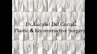 Vaginoplasty Preparation Video Tutorial Dr. Gabriel Del Corral.