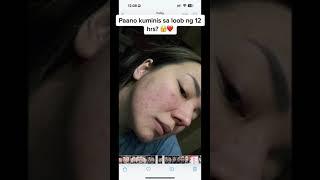 Grabe ka ROSMAR KOJIC PEELING SOAP at ROSMAR ICE SLEEPING MASK ️#rosmar #PINAKAMALAKAS #viral