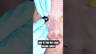 How To Take Out Huge Sclera Halloween Contacts Method 1