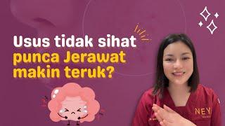 Beauty Tips  Usus tidak sihat punca jerawat makin teruk?