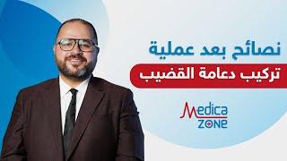 نصائح بعد عملية تركيب دعامة القضيب  دكتور صلاح الهمشري  Medicazone