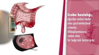 Crohn hastalığı nedir? Crohn hastalığı nasıl tedavi edilir? - Doç. Dr. Tolga Konduk