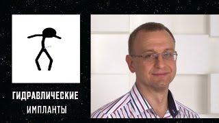 ПРОТЕЗИРОВАНИЕ. ГИДРАВЛИЧЕСКИЕ ИМПЛАНТЫ. Уролог андролог сексопатолог Алексей Корниенко.