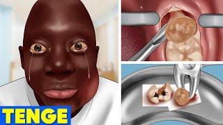 ASMR Wisdom teeth removal for Rango Tenge Tenge  Cavity Treatment Animation  WOW Brain Video