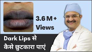 Dark Lips Treatment How to Get Rid of Dark Lips Dark Lips से कैसे छुटकारा पाएं  In HINDI