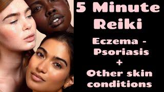 Reiki l Eczema - Psoriasis + Other Skin Conditions l 5 Min Session l Healing Hands Series 