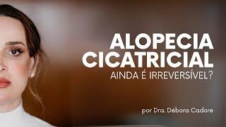 Alopecia Cicatricial ainda é irreversível?