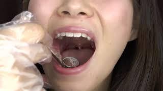 Cute Japanese Girls Throat and Uvula