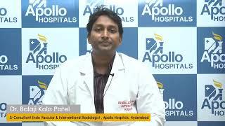 Are Spider Veins dangerous? How does it differ from Varicose Veins?  Apollo Hospitals