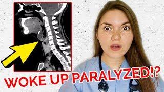 28 YEAR OLD PARALYZED IN HIS SLEEP Real Medical Case